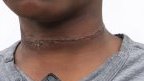 Violences sur mineur au PK18&nbsp;: une mère arrêtée, l’enfant pris en charge