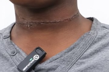 Violences sur mineur au PK18&nbsp;: une mère arrêtée, l’enfant pris en charge