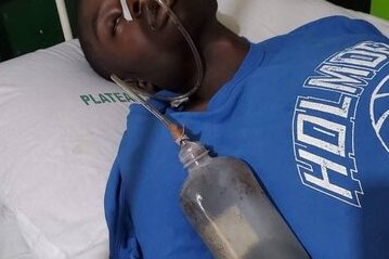 Libreville&nbsp;: un mineur gabonais, orphelin, violemment agressé par son tuteur adoptif présumé