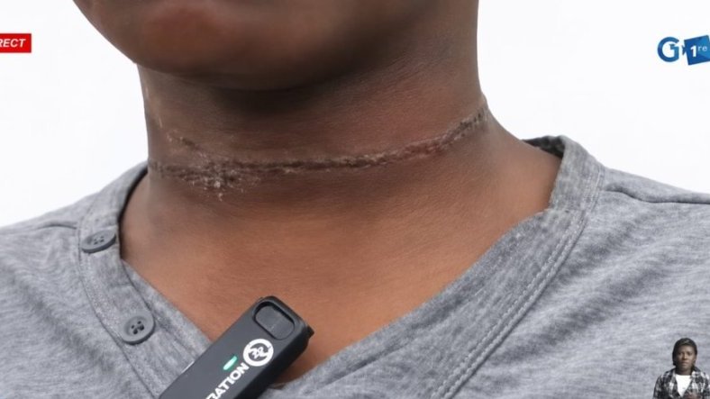 Violences sur mineur au PK18&nbsp;: une mère arrêtée, l’enfant pris en charge